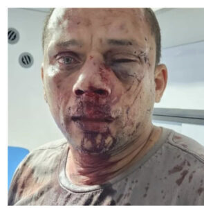 Professor é violentamente espancado no interior do Maranhão