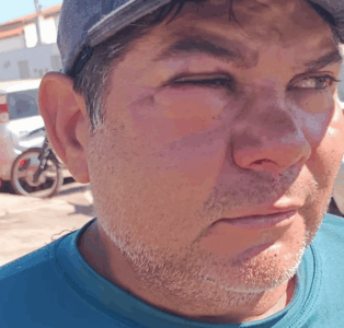 Ex-vereador agride servidor público durante apreensão de animais no Piauí