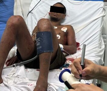 Segundo suspeito de assalto é preso após procurar atendimento médico em hospital de São Luís; o comparsa morreu