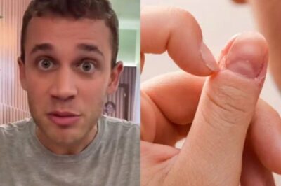 Jovem Sofre AVC Após Infecção Causada Pelo Hábito de Roer Unhas