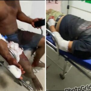 Três pessoas ficam feridas após ataque de pitbulls em Paço do Lumiar
