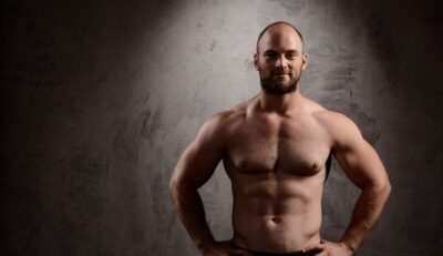 Uso indevido de hormônios para ganho de massa muscular pode causar calvície