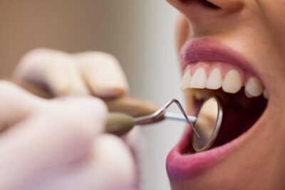 Cinco dicas para evitar perda de dentes e manter o sorriso saudável e bonito