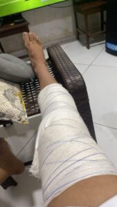 SUB 20: Atleta do Pitanguense se recupera bem após incidente que suspendeu a partida com o Maranhão
