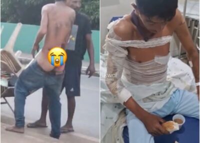 Morador de rua é amarrado e arrastado pelas ruas de Coroatá; homem é baleado na cabeça