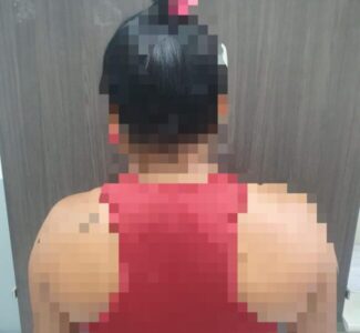 POLÍCIA CIVIL PRENDE MULHER QUE TENTOU MATAR POR DUAS VEZES O EX- COMPANHEIRO EM SÃO LUÍS
