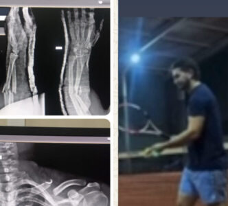 Enquanto Secretário Eduardo Sá joga tênis em São Paulo, paciente recorre à Promotoria por atendimento no Antenor Abreu em Pinheiro