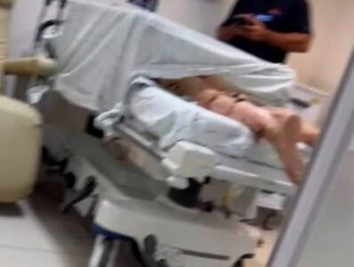 Morre no UDI hospital vítima de incêndio no Rio Anil Shopping ocorrido há um mês