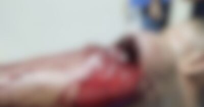Homem sofre tentativa de homicídio no Bairro Rosalina em Vargem Grande