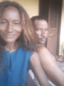 Feminicídio em São Vicente Ferrer: Mulher que teve 90% do corpo queimado pelo marido morre no hospital