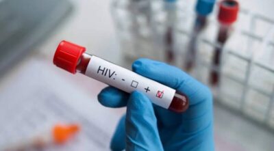 Cientistas desenvolvem nanopartículas de mRNA que podem levar à cura do HIV