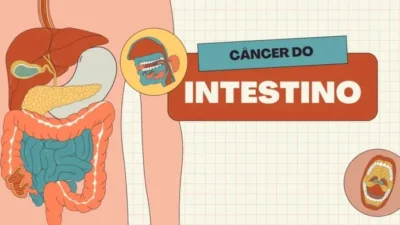 CÃNCER NO INTESTINO : VOCÊ SABE RECOMHECER OS 6 PRINCIPAIS SINTOMAS