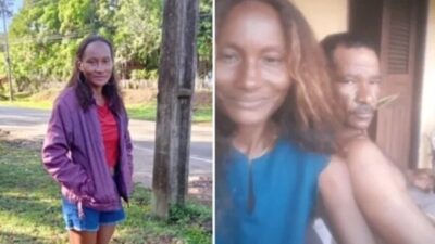Mulher que teve 90% do corpo queimado morre em hospital no MA; marido está preso
