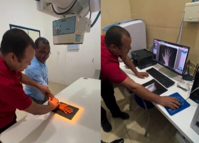 Hospital Dr. Neto Guterres recebe sala de Raio-X equipada e já em operação