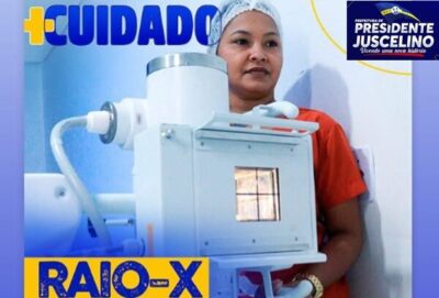 Presidente Juscelino, vive um novo tempo na saúde, ganha um aparelho de raio-X