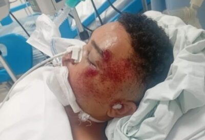 Jovem de Paulino Neves sofre acidente grave em Alta Floresta e família pede ajuda para transferência urgente