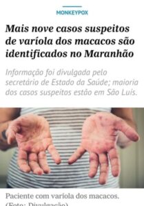 SES anuncia novos casos de varíola dos macacos no Maranhão…