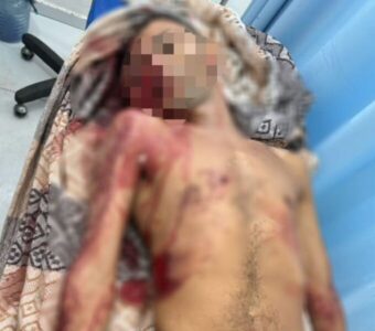 Tombou! Faccionado que acobertava assassino do major da PM é morto em confronto com a polícia em Barreirinhas!
