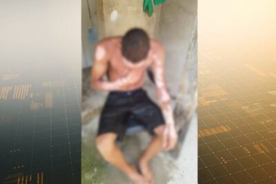 Mulher não aceita término e ateia fogo no ex-companheiro no Bairro de Fátima