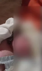 Mulher suspeita de abandonar bebê em área de lixão é presa