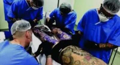 Conselho Federal de Medicina proíbe uso de anestesia para tatuagens estéticas