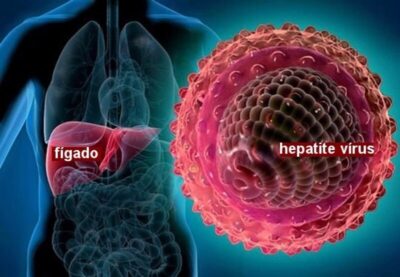 Julho amarelo: hepatites virais podem apresentar sintomas inespecíficos e demandam atenção redobrada