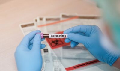 Pesquisadores brasileiros avançam no sequenciamento do coronavírus