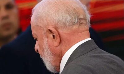 Lula passará por nova cirurgia nesta quinta para bloquear fluxo de sangue no crânio