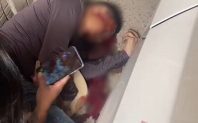 Homem é executado com tiros na cabeça na Cidade Olímpica, em São Luís