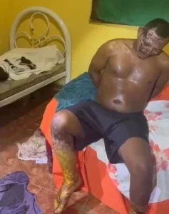 Homem que matou ex-companheira e ainda colocou fogo na casa da vítima é preso
