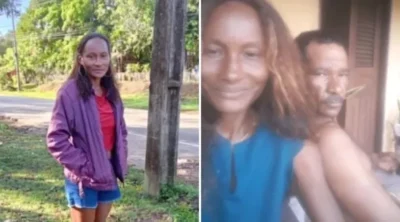 Mulher que teve 90% do corpo queimado morre em hospital no MA; marido está preso