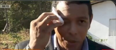 Assista: Repórter da TV Meio sangra após agressão de acusada de tráfico de drogas em Teresina