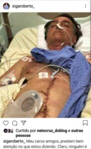 Querem tomar mandatos depois que perderam no voto? Senador fala sobre respeito à vontade do povo e democracia, usando a imagem de Bolsonaro após facada, das incansáveis tentativas de impedí-lo a todo custo, ainda que parando o Brasil…