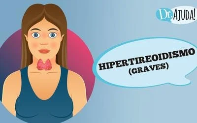 Hipertireoidismo, o que é e como tratar ?