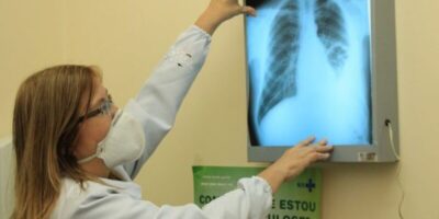 Maranhão registrou  quase 13 mil casos de tuberculose em 5 anos