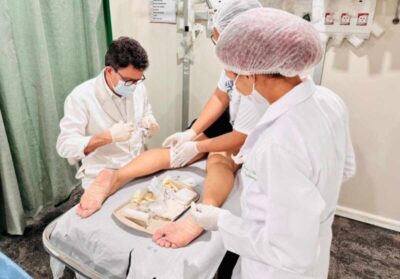Prefeitura de Pinheiro realiza mais um mutirão de cirurgias de varizes no Hospital Antenor Abreu