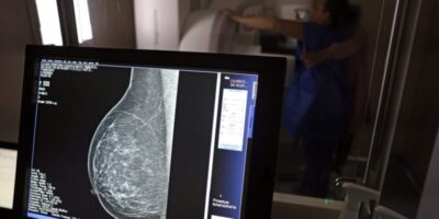 AGU processa médico que apontou mamografia como causadora de câncer