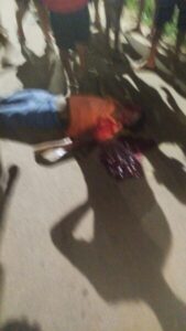 Homem é executado a tiros na Cidade Olímpica, em São Luís