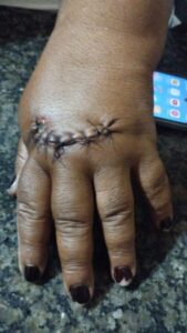 Morros: vereador e companheira se envolvem em confusão no Rio Una, com agressão a casal de comerciantes