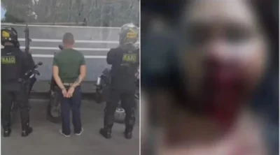 Homem é preso por desfigurar rosto de companheira com socos enquanto ela dormia