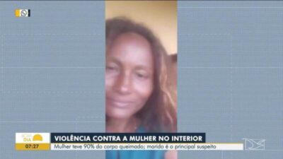 Mulher tem 90% do corpo queimado e marido é preso como principal suspeito no MA