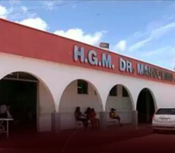 Um bebê teve a cabeça d3c3p4d4 após um parto mal sucedido