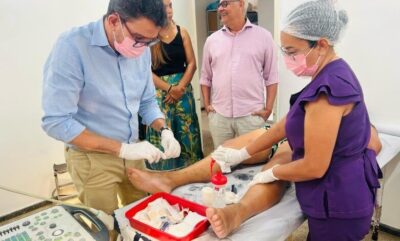 Prefeito Zé Martins promove mutirão inédito de Cirurgias de Varizes em Bequimão