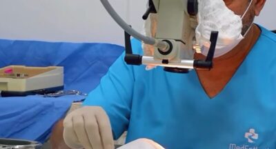 Prefeitura de Bernardo do Mearim realiza cirurgias de catarata e pterígio com recursos próprios e garante mais saúde para a população