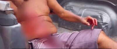 Homem é esfaqueado em Trizidela do Vale após discussão por bacia plástica do tipo Tupperware