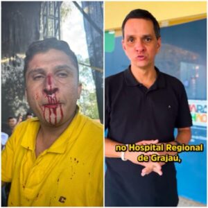 Assessor do deputado Ricardo Arruda foi levado para hospital após ser agredido por familiares e aliados do prefeito Dr. Gilson em Grajaú