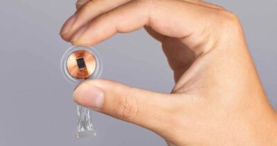 Implante cerebral promete revolucionar conexão entre mente e máquina