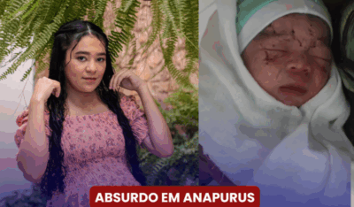 Anapurus: Parto Forçado, Marcas no Bebê e Mãe em Estado Grave na UTI de Coroatá