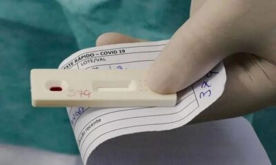 Em meio a explosão de casos de gripe, postos de saúde disponibilizam testes rápidos de Covid-19