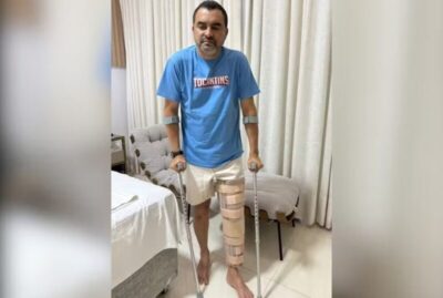 Governador do Tocantins sofre lesão no joelho durante partida de futebol